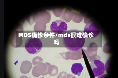 MDS确诊条件/mds很难确诊吗