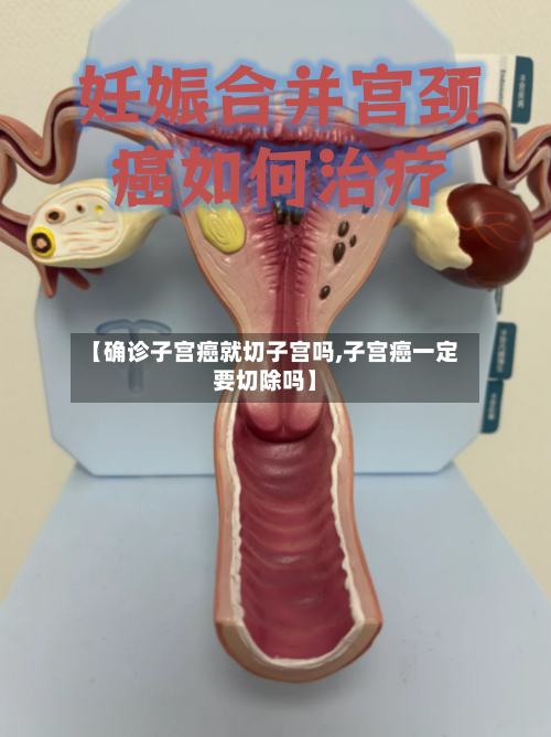 【确诊子宫癌就切子宫吗,子宫癌一定要切除吗】-第1张图片