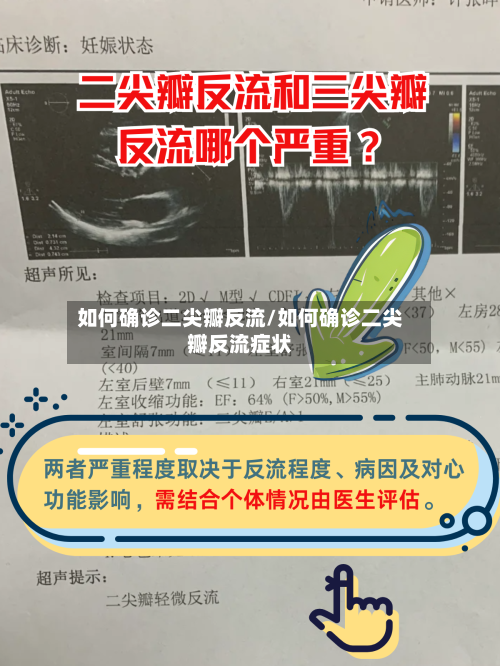 如何确诊二尖瓣反流/如何确诊二尖瓣反流症状-第1张图片