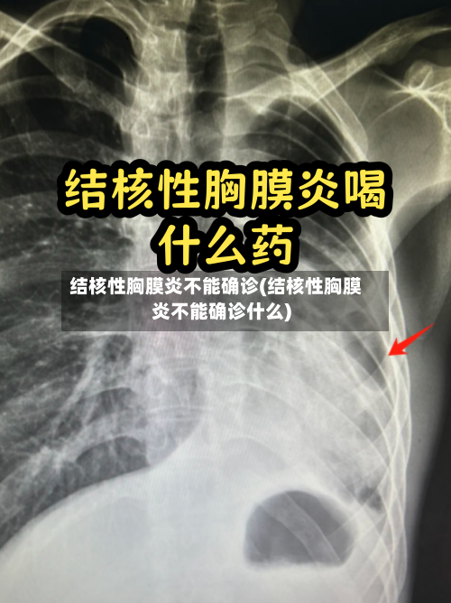 结核性胸膜炎不能确诊(结核性胸膜炎不能确诊什么)-第1张图片
