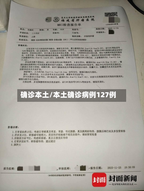 确诊本土/本土确诊病例127例