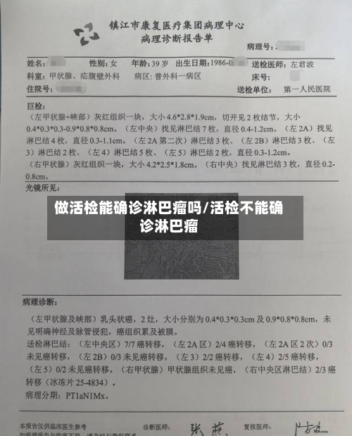 做活检能确诊淋巴瘤吗/活检不能确诊淋巴瘤-第2张图片