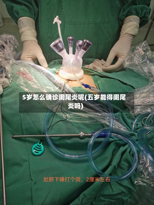 5岁怎么确诊阑尾炎呢(五岁能得阑尾炎吗)