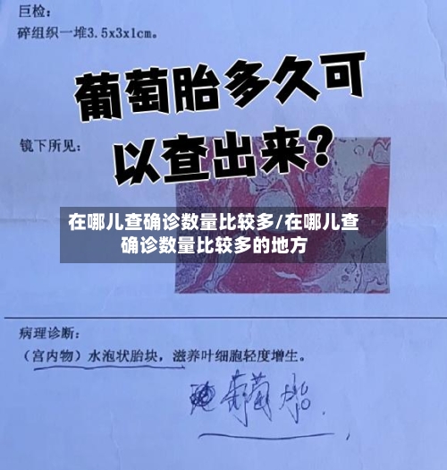 在哪儿查确诊数量比较多/在哪儿查确诊数量比较多的地方-第3张图片