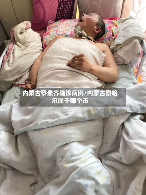 内蒙古察素齐确诊病例/内蒙古察哈尔属于哪个市-第2张图片