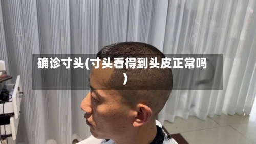 确诊寸头(寸头看得到头皮正常吗)-第2张图片