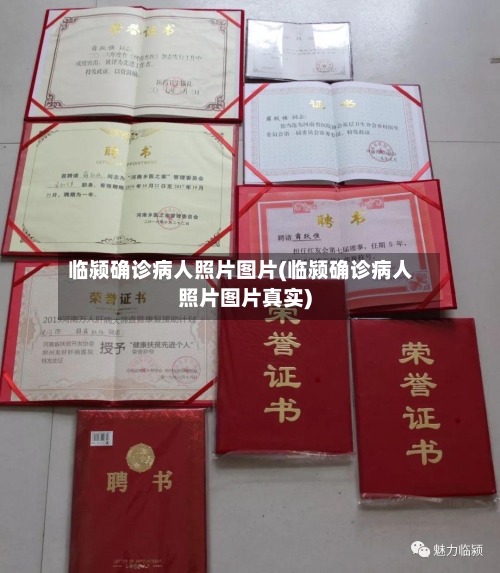 临颍确诊病人照片图片(临颍确诊病人照片图片真实)-第2张图片