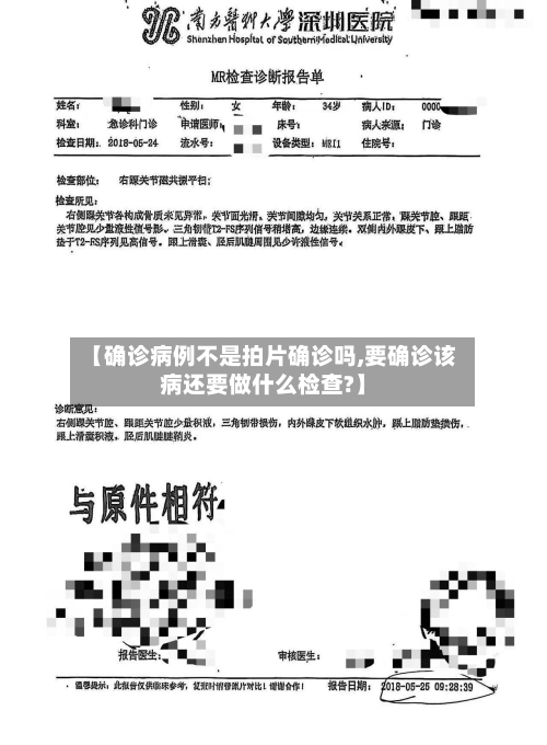 【确诊病例不是拍片确诊吗,要确诊该病还要做什么检查?】