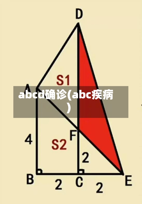 abcd确诊(abc疾病)-第2张图片
