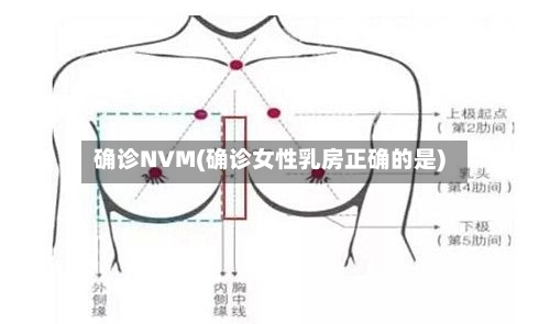 确诊NVM(确诊女性乳房正确的是)-第2张图片