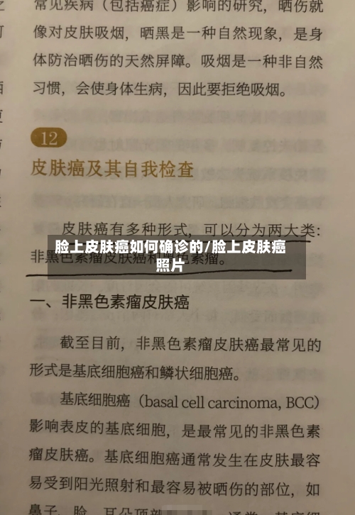 脸上皮肤癌如何确诊的/脸上皮肤癌照片-第2张图片