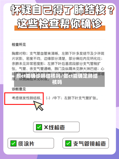 照ct能确诊肺结核吗/做ct能确定肺结核吗