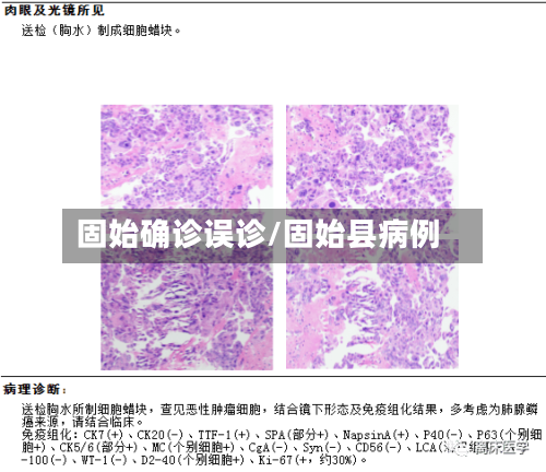 固始确诊误诊/固始县病例
