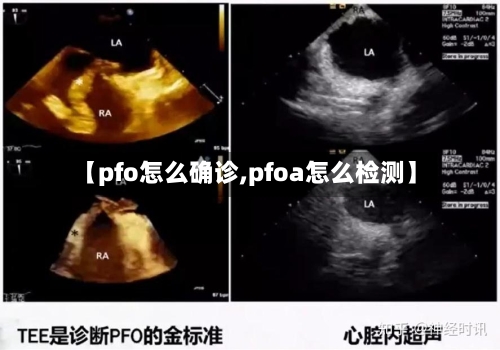 【pfo怎么确诊,pfoa怎么检测】