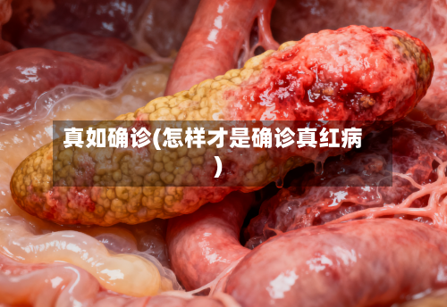 真如确诊(怎样才是确诊真红病)