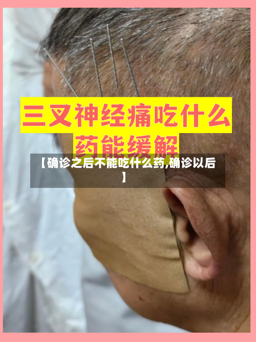 【确诊之后不能吃什么药,确诊以后】-第3张图片