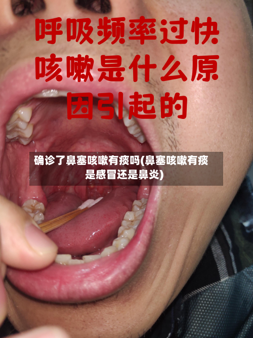 确诊了鼻塞咳嗽有痰吗(鼻塞咳嗽有痰是感冒还是鼻炎)
