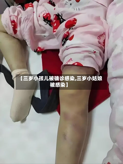 【三岁小孩儿被确诊感染,三岁小姑娘被感染】