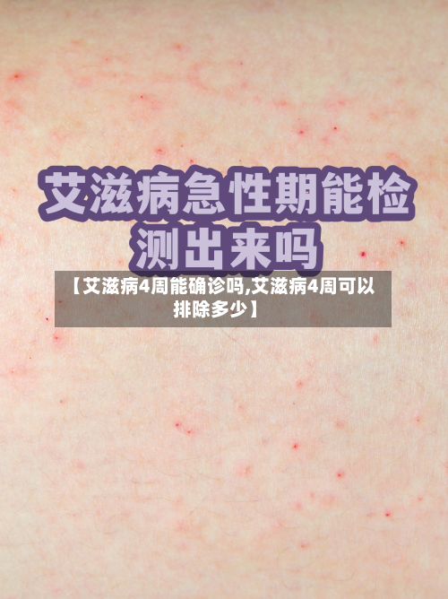 【艾滋病4周能确诊吗,艾滋病4周可以排除多少】-第2张图片
