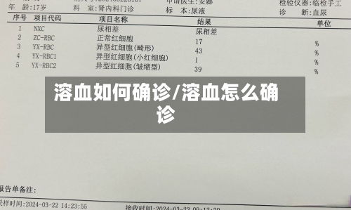 溶血如何确诊/溶血怎么确诊