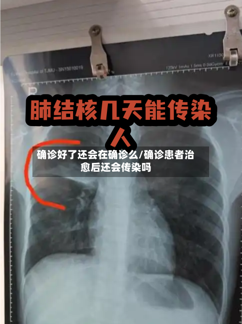 确诊好了还会在确诊么/确诊患者治愈后还会传染吗-第2张图片