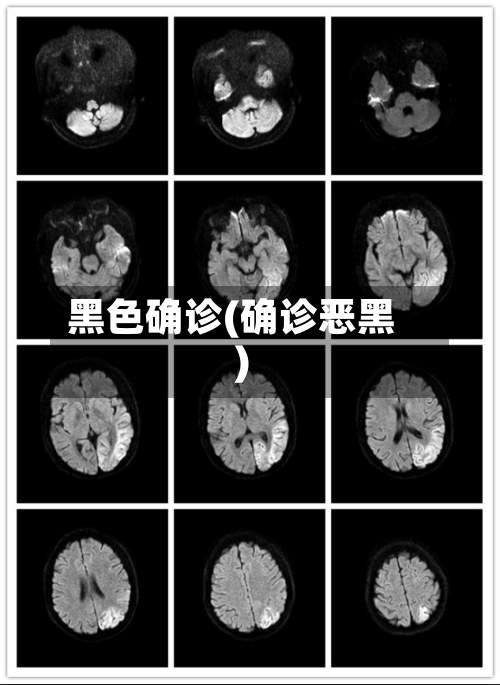 黑色确诊(确诊恶黑)-第2张图片