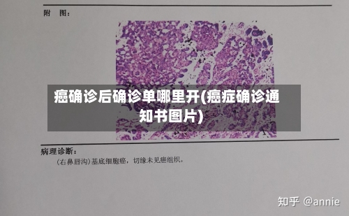 癌确诊后确诊单哪里开(癌症确诊通知书图片)