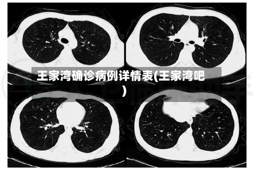 王家湾确诊病例详情表(王家湾吧)