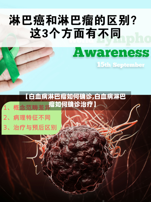 【白血病淋巴瘤如何确诊,白血病淋巴瘤如何确诊治疗】-第2张图片