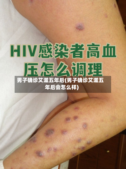 男子确诊艾滋五年后(男子确诊艾滋五年后会怎么样)