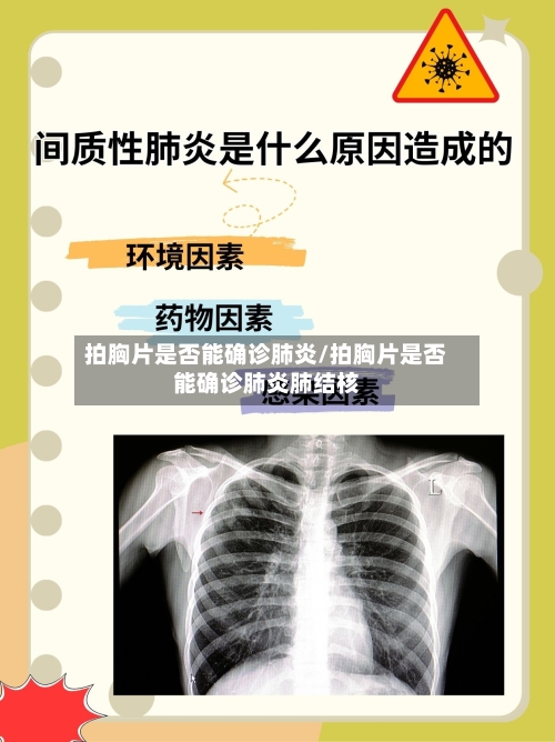 拍胸片是否能确诊肺炎/拍胸片是否能确诊肺炎肺结核