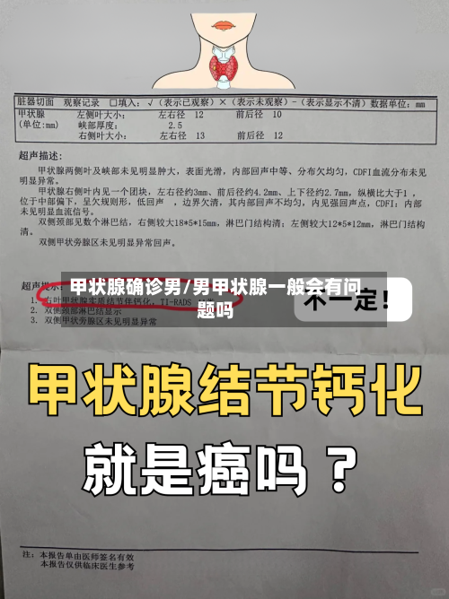 甲状腺确诊男/男甲状腺一般会有问题吗-第3张图片