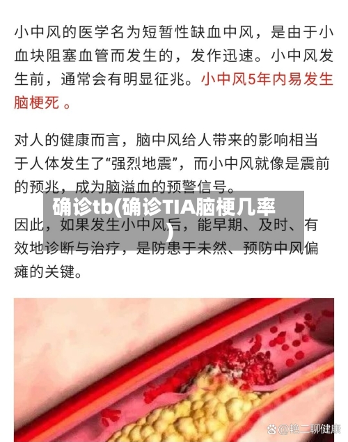 确诊tb(确诊TIA脑梗几率)-第3张图片