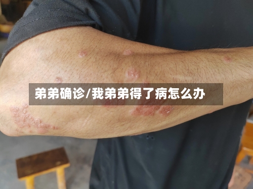 弟弟确诊/我弟弟得了病怎么办
