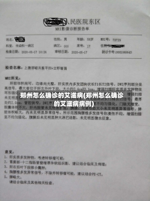 郑州怎么确诊的艾滋病(郑州怎么确诊的艾滋病病例)